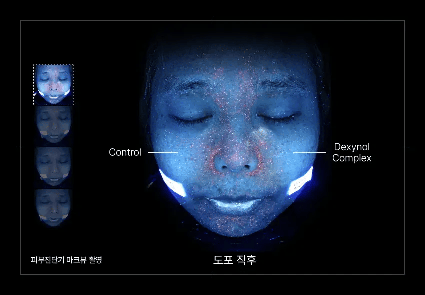 Dexynol-16.3 Acne-Line Trio Set - PROMOTION-3